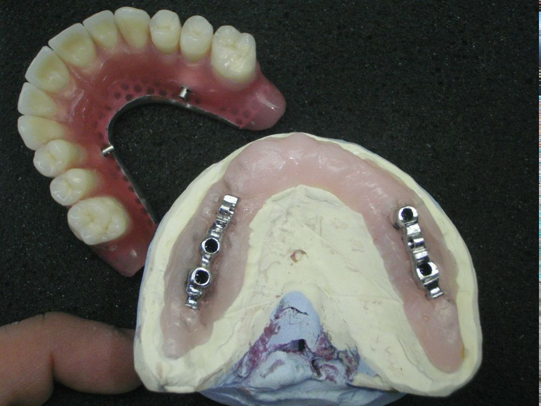 Эрнест Абрамян | Москва