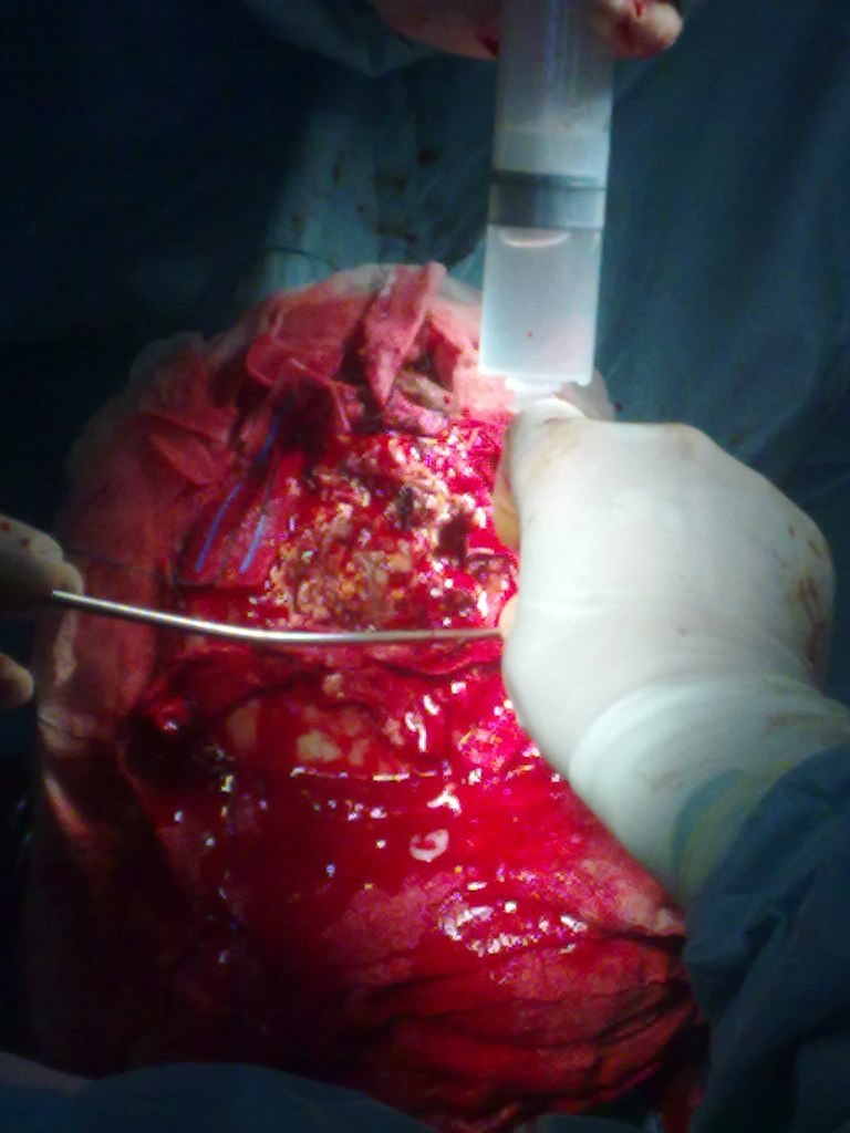 Эльгюн Мамедов | Москва