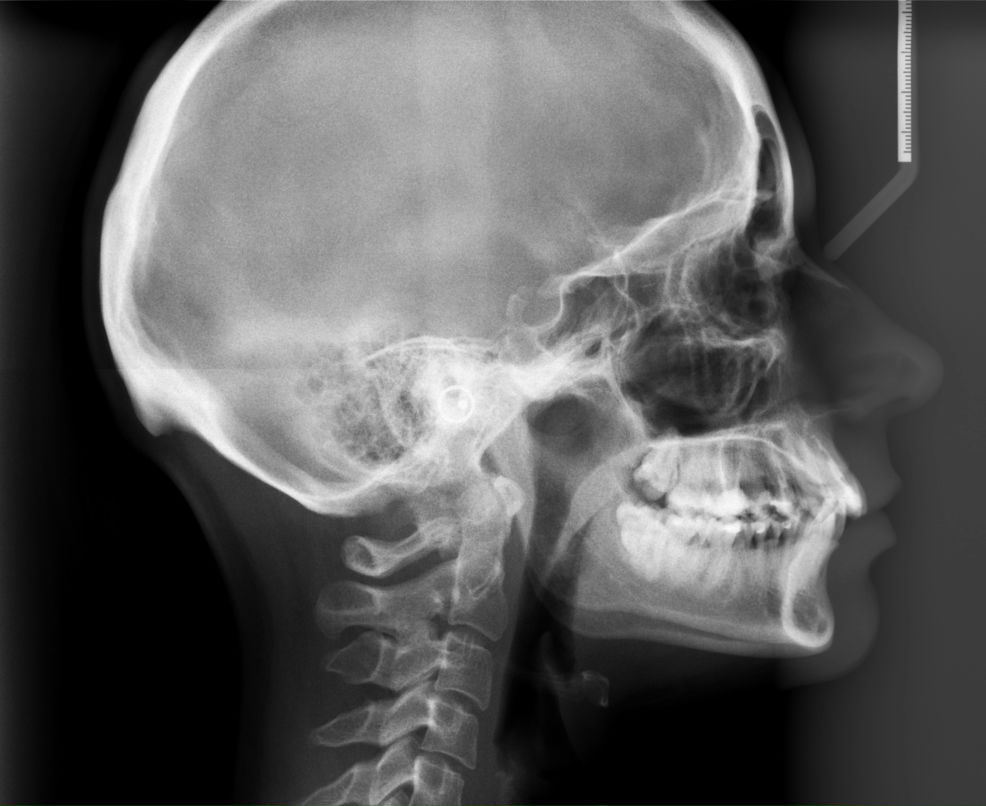 Екатерина Сидоревич | Тюмень